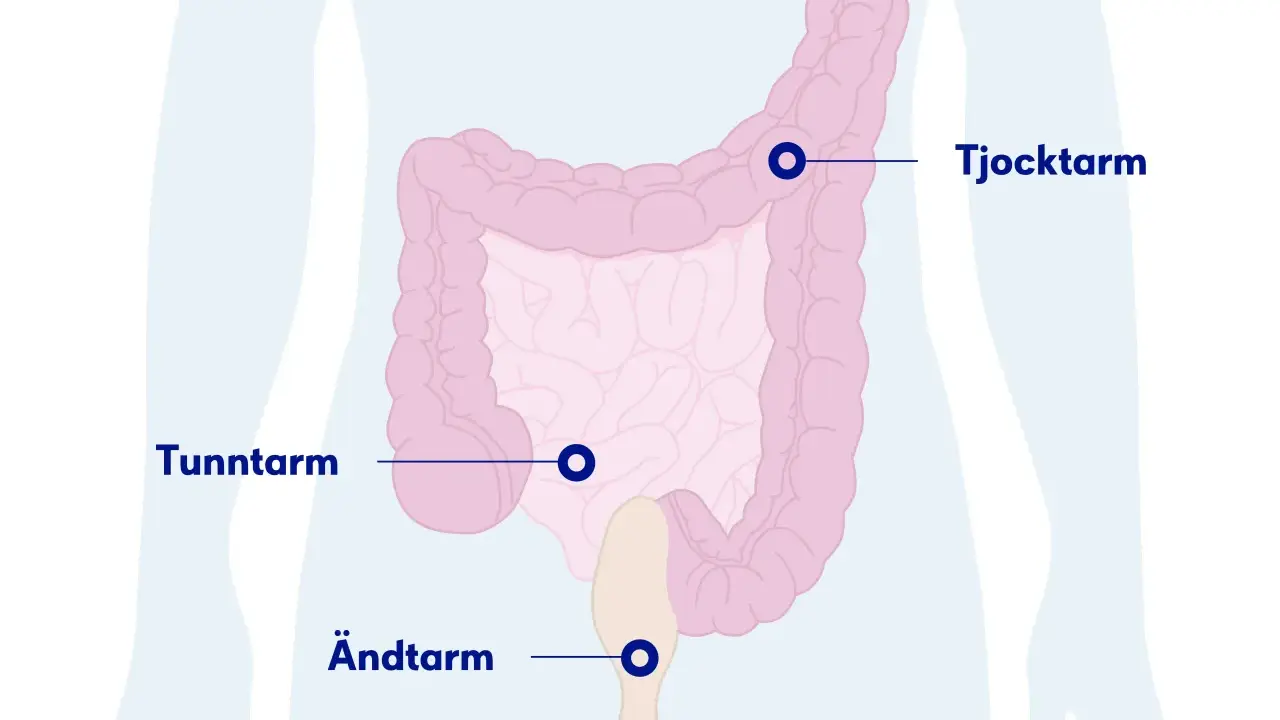 Illustration av tunntarm, tjocktarm och ändtarm. Om du har ont i magen kan det bero på problem i dessa delar.