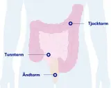 Illustration av tunntarm, tjocktarm och ändtarm. Om du har ont i magen kan det bero på problem i dessa delar.