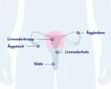 Illustration av kvinnans reproduktionsorgan. Visar livmoder, äggstockar, äggledare, livmoderhals och slida. Kan illustrera tillstånd som myom i livmodern.
