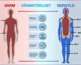 Diagrammet visar hur kroppen förlorar värme. Till vänster en varm kropp, till höger en nedkyld kropp med lägre kroppstemperatur.