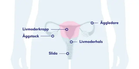 Illustration av kvinnans reproduktionsorgan. Visar livmoder, äggstockar, äggledare, livmoderhals och slida. Kan illustrera tillstånd som myom i livmodern.