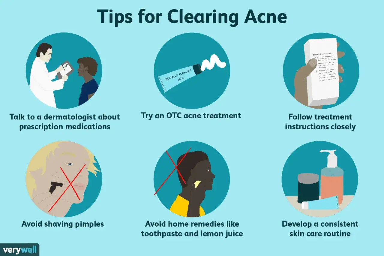 Tips f&ouml;r att hantera acne hos en ton&aring;ring: prata med l&auml;kare, anv&auml;nd receptfria medel, f&ouml;lj instruktioner, undvik att raka finnar, inga huskurer, och ha en hudv&aring;rdsrutin.