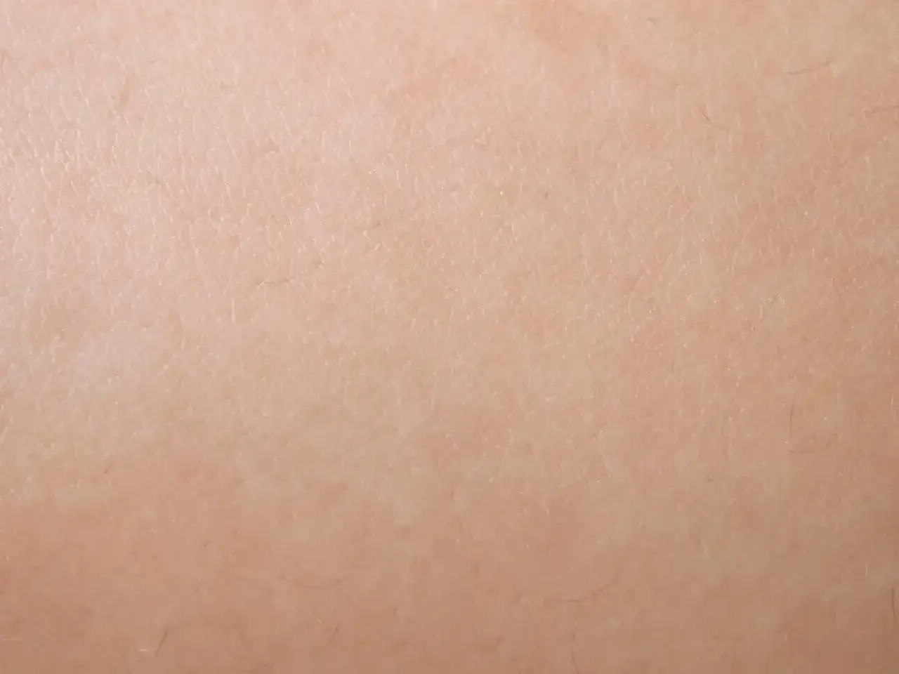 N&auml;rbild p&aring; hud med sm&aring; knottror, typiskt f&ouml;r keratosis pilaris.